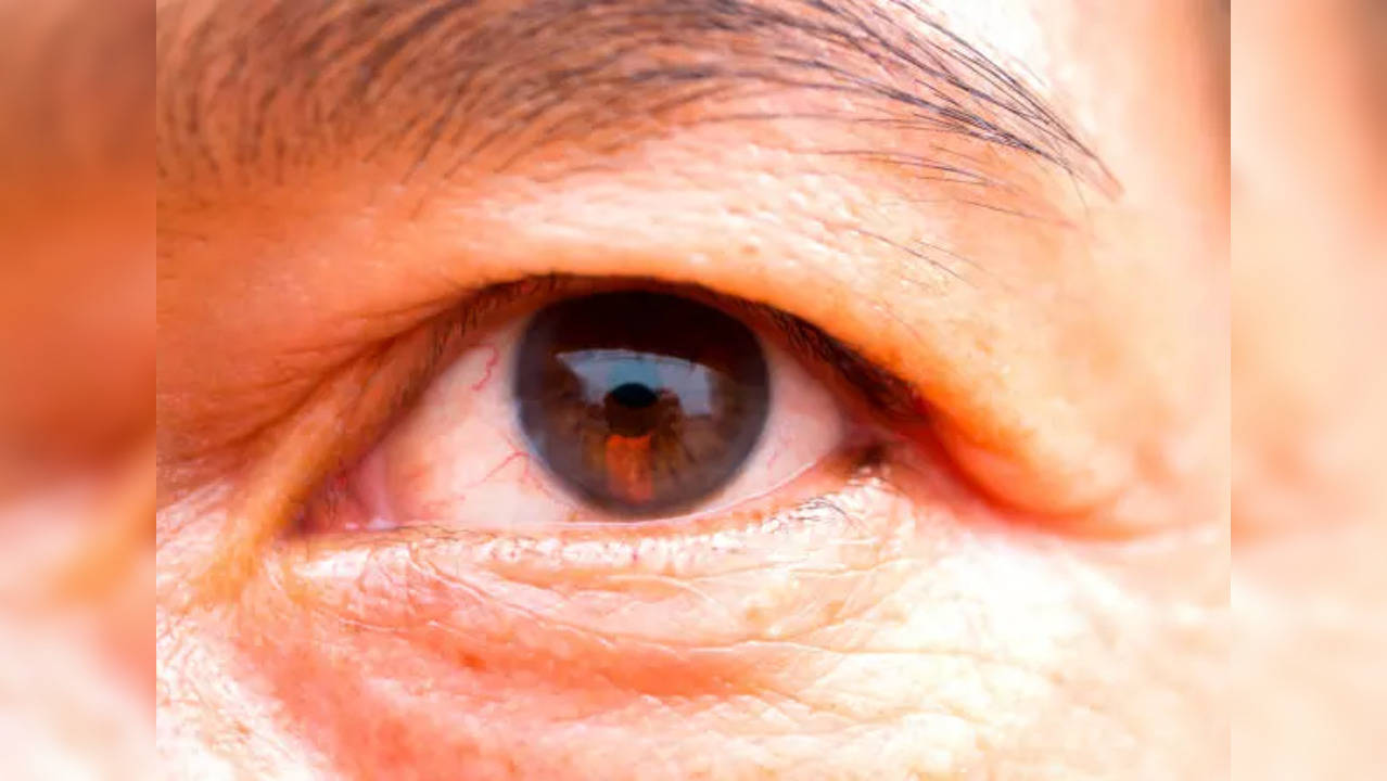 eyes