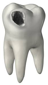 tooth-hole.jpg